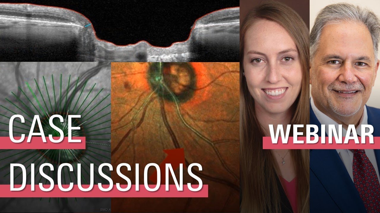 Differentiating A Glaucoma Suspect from Early Glaucoma: An Interactive Discussion