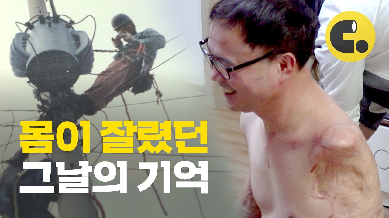 깨어나보니 다리 절단 환자가 되어 있었다 | 산업재해 노동자들의 경험 | 씨리얼 사회탐구