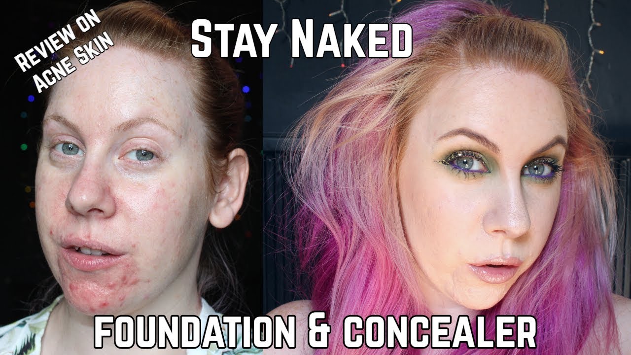 Urban Decay Stay Naked Foundation & Concealer Review on Acne Skin