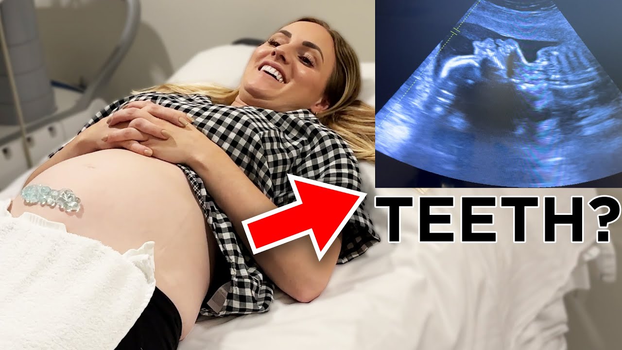 21 Week Ultrasound Completley Shocks Us!