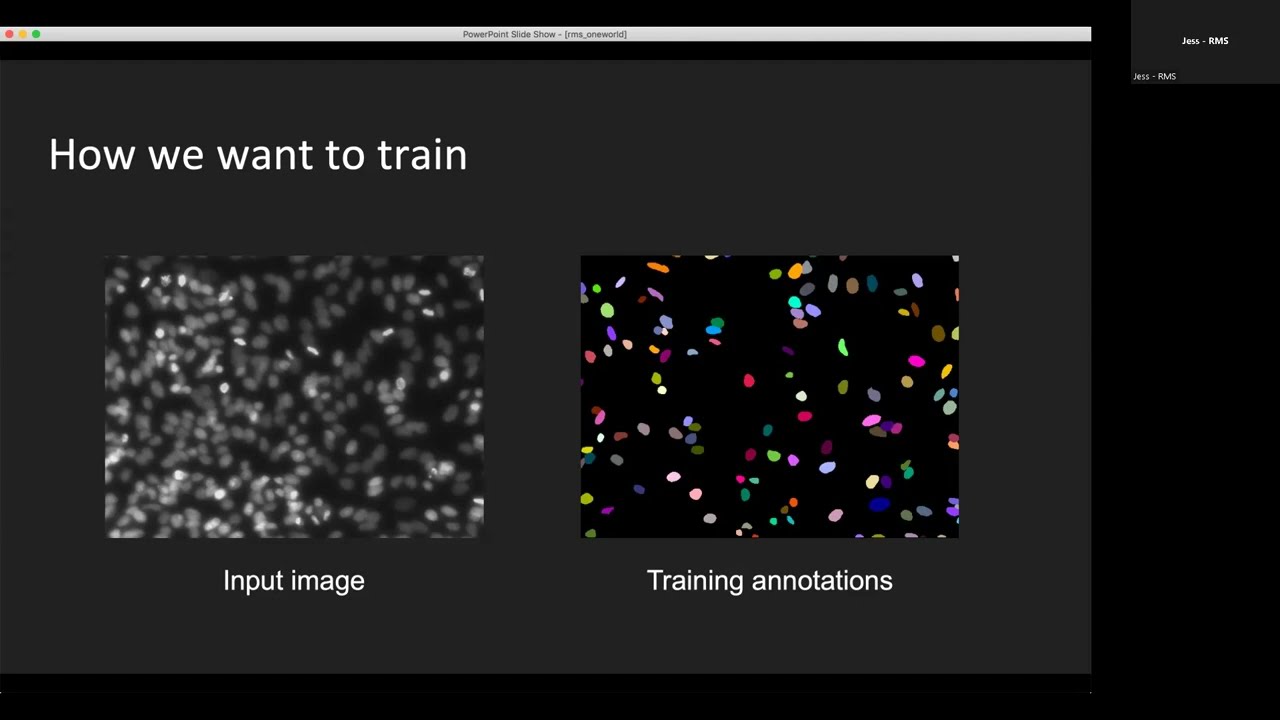 Anna Kreshuk - Machine learning for microscopy with less training data - Imaging ONEWORLD