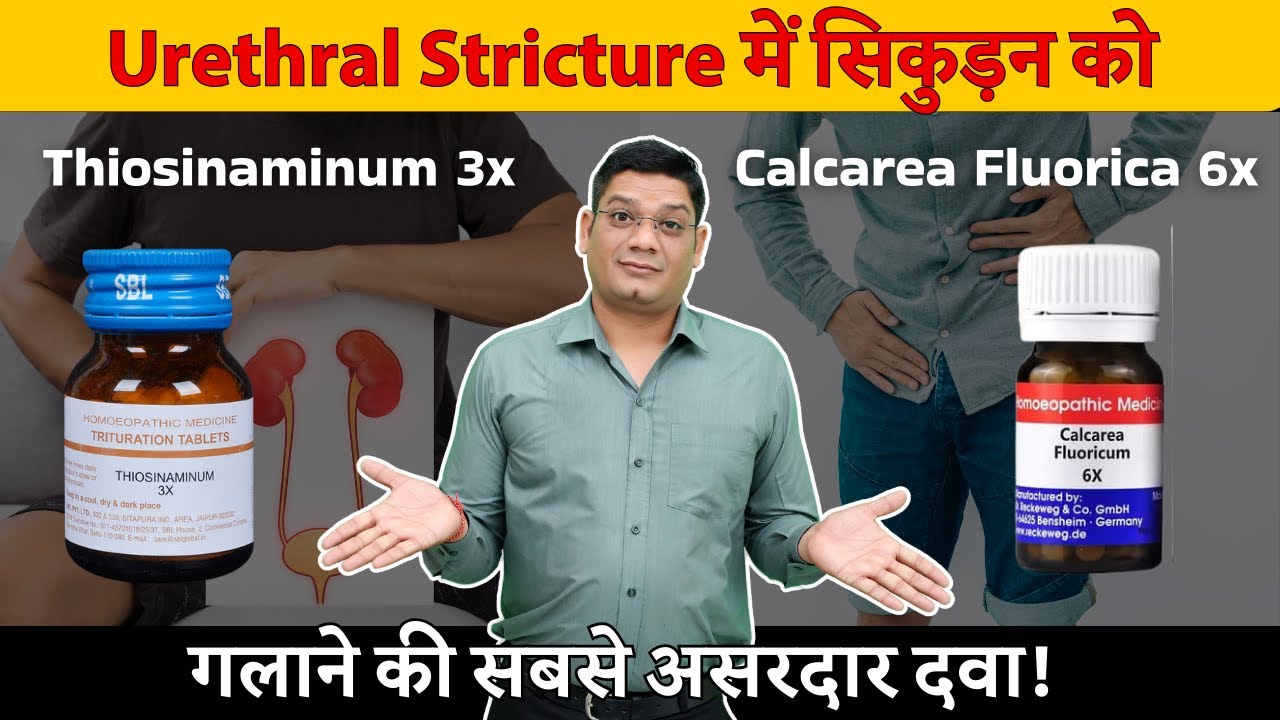 Best Homeopathic Medicines for Urethral Stricture | Thiosinaminum 3x & Calcarea Fluor 6x |Dr Patidar