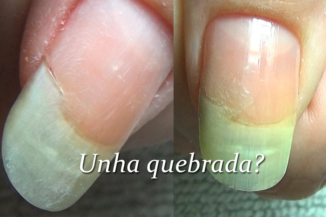Unha quebrada aprenda como recuperar | Fa&ccedil;a voc&ecirc; mesma