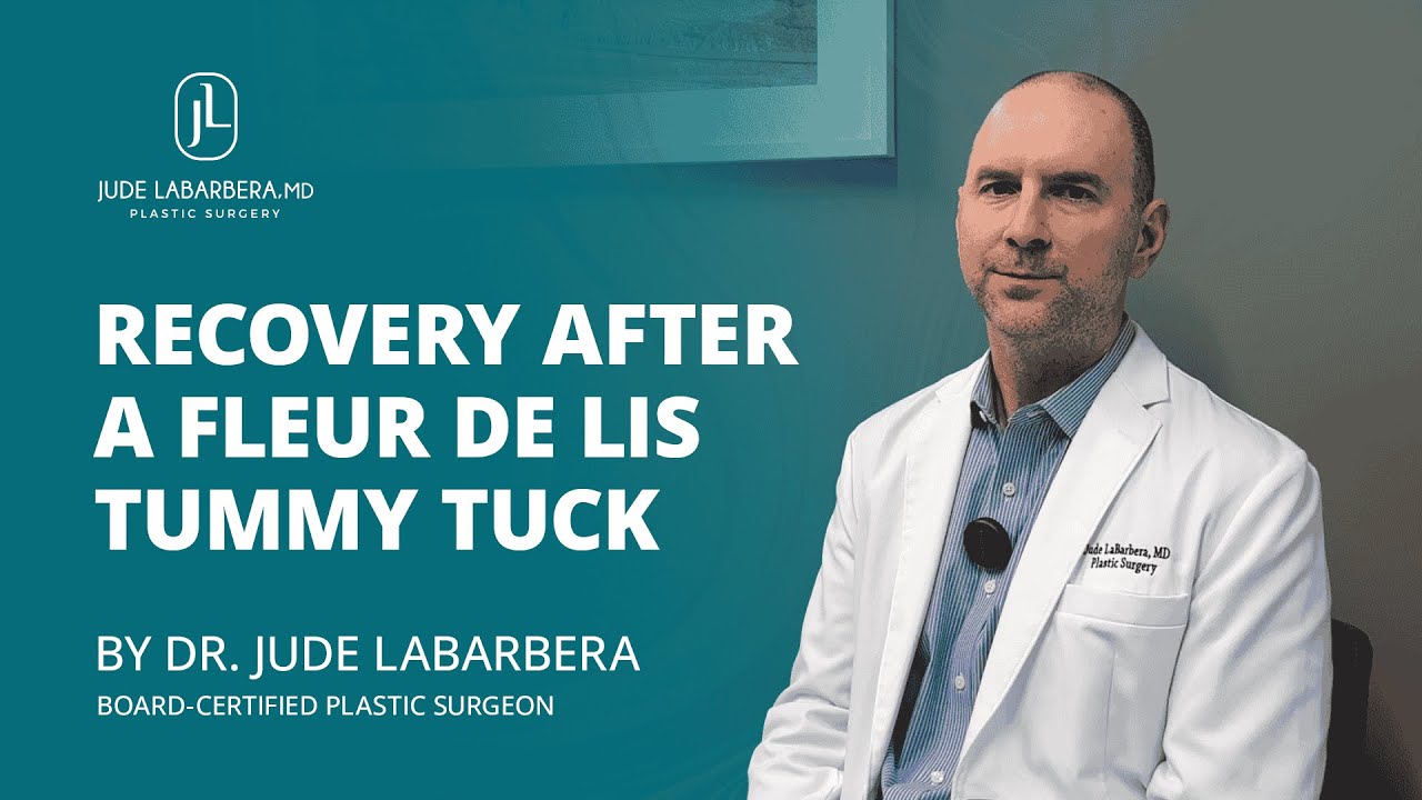 Fleur de Lis Tummy Tuck Recovery Guide by Dr. LaBarbera
