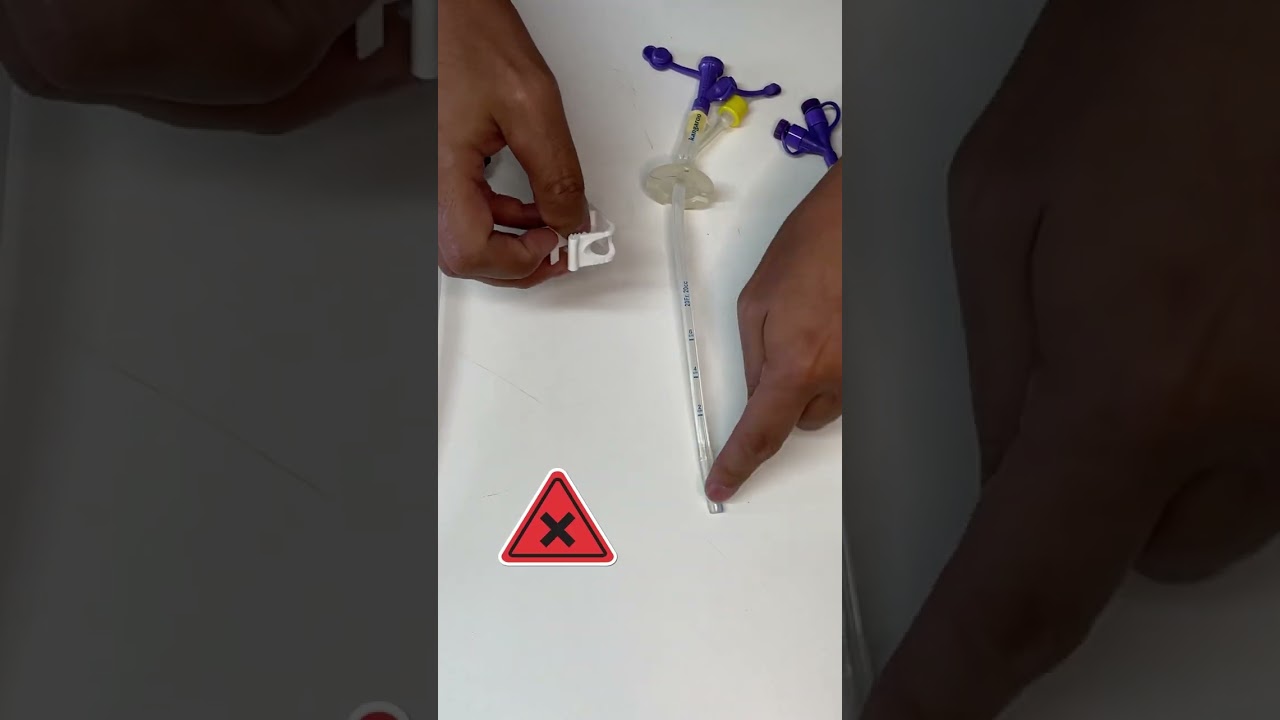Usando CLAMP na sonda GTT de Gastrostomia