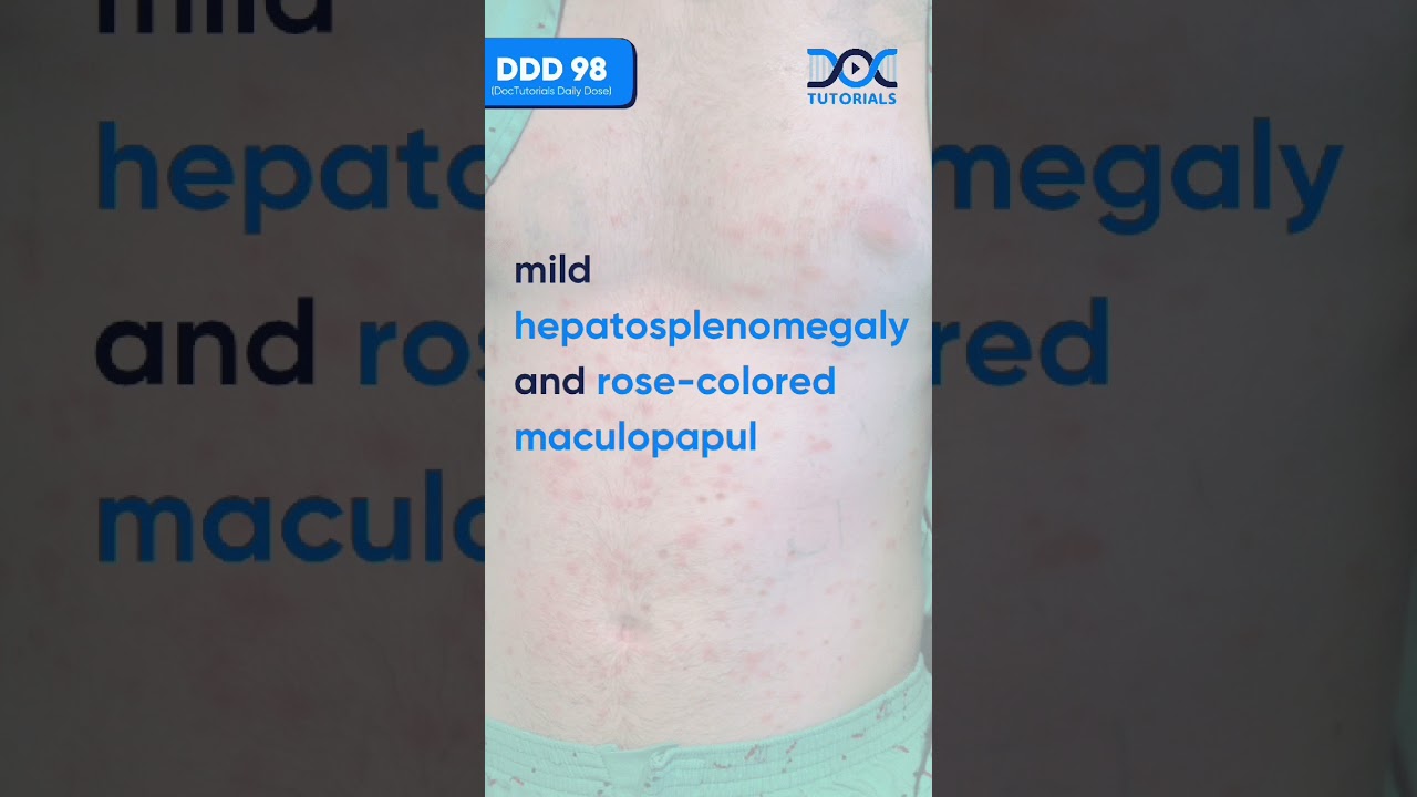 10 Days of High Fever & Rash &ndash; Can You Diagnose This Case? | DocTutorials Daily Dose | Microbiology