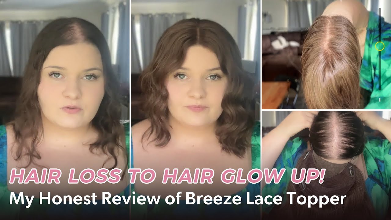 Hair Loss to Hair GLOW UP! My Honest Review of Breeze Lace Topper | UniWigs Breeze