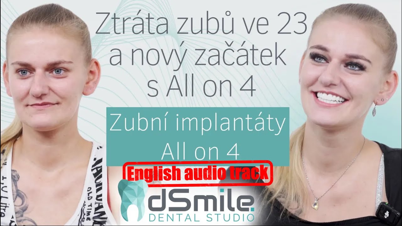 Šok ve 23 letech: Jak jsem získala nový úsměv s All on 4 od dSmile #implant #dentist #dsmile