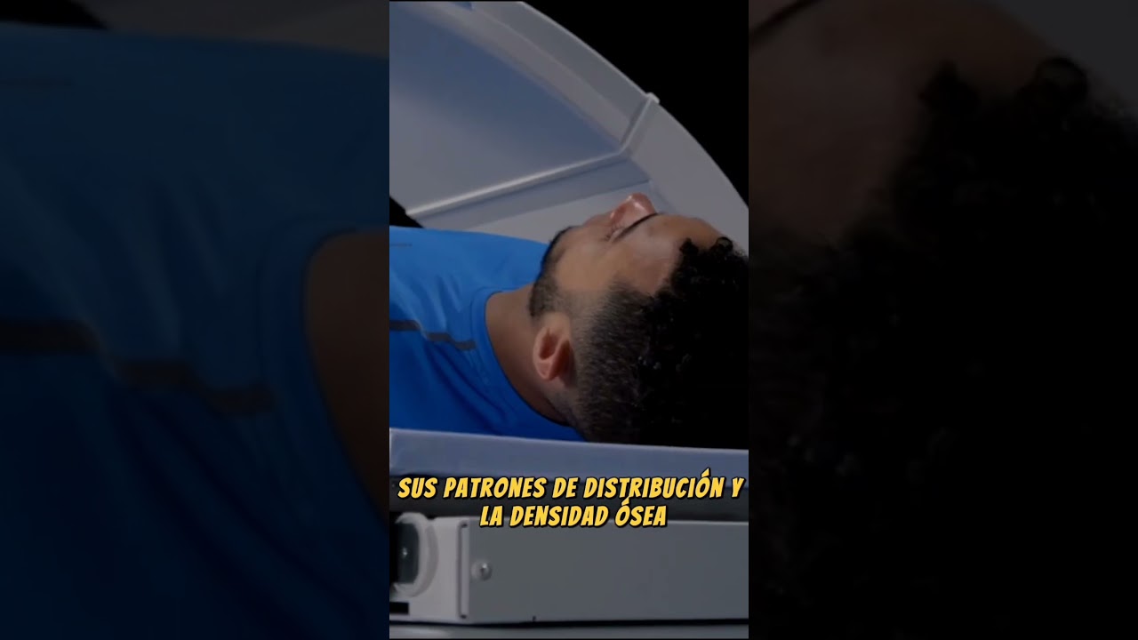 DENSITOMETRÍA, DEXA o DXA: el estudio de la COMPOSICIÓN CORPORAL más avanzado en la actualidad ☢️