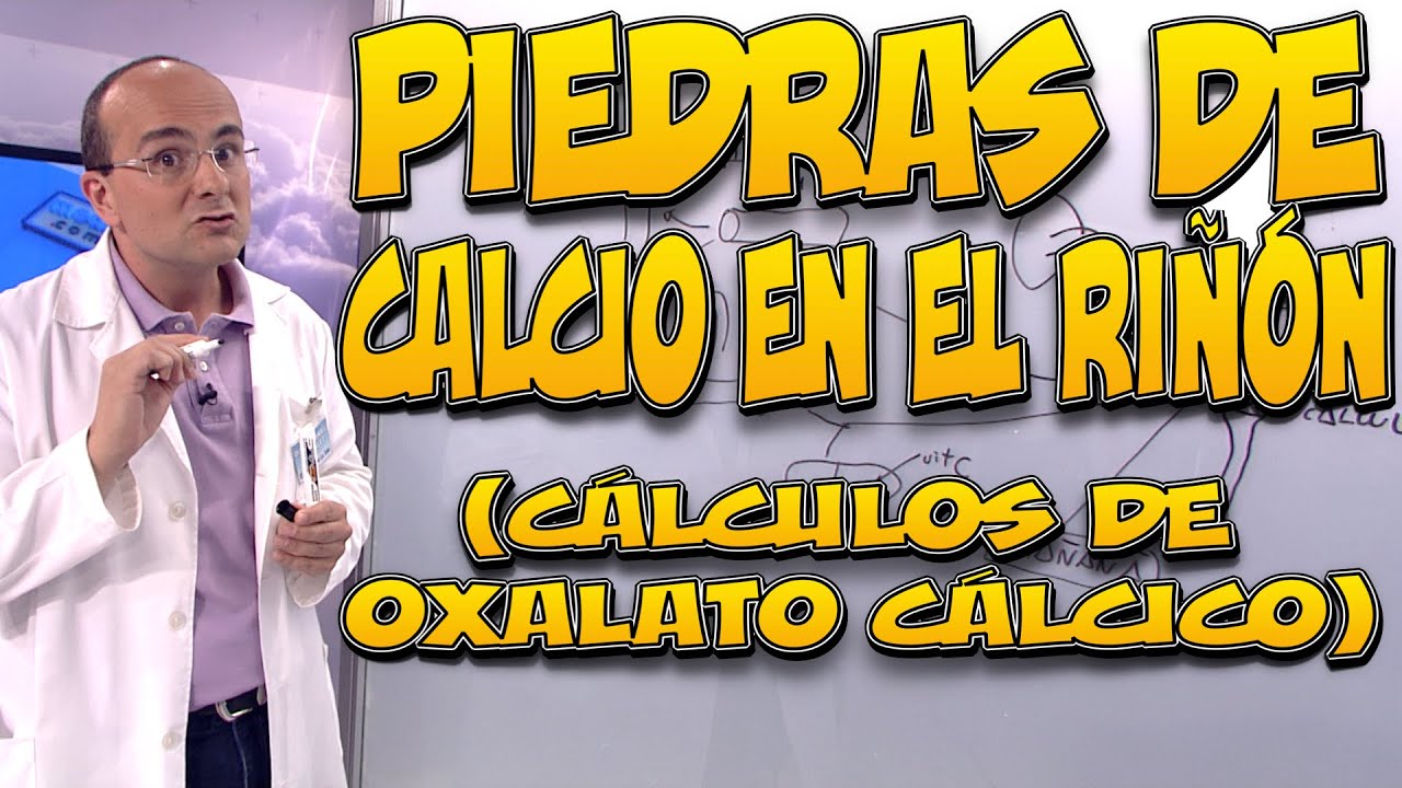 PIEDRAS de CALCIO en el RIÑÓN (OXALATO CÁLCICO) SÍNTOMAS, DIAGNÓSTICO, TRATAMIENTO, CÓMO PREVENIRLOS
