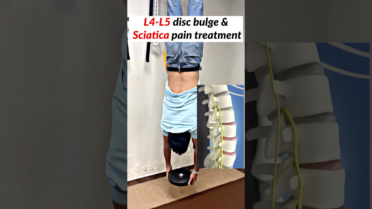 L4 - L5 disc bulge treatment &  sciatica pain treatment