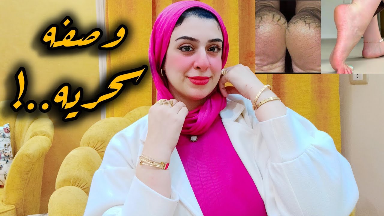 أتخلصي من تشققات القدم بخطوتين بس ودعيها من أول أستخدام مهما كان شكلها ودرجتها-نعومه لمعان توريد