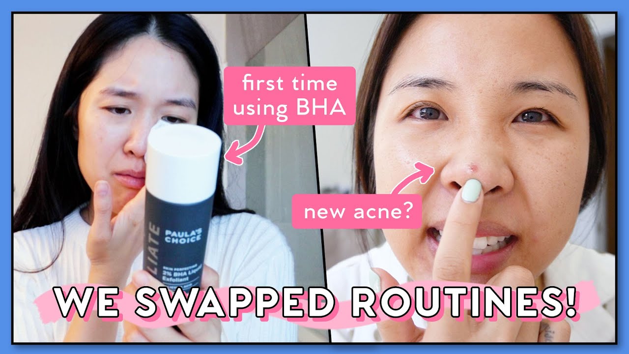 We Swapped Our Oily/Acne & Dry Skin Routines for 1 WEEK! Bad idea....lol