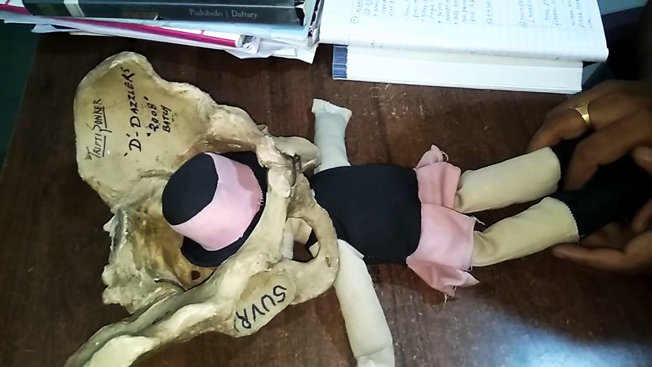 Burn marshall method of after coming head