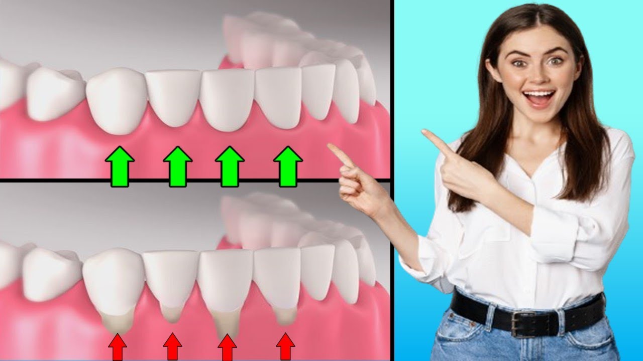 Revealing The 15 Surprising Remedies For Natural Gum Regrowth