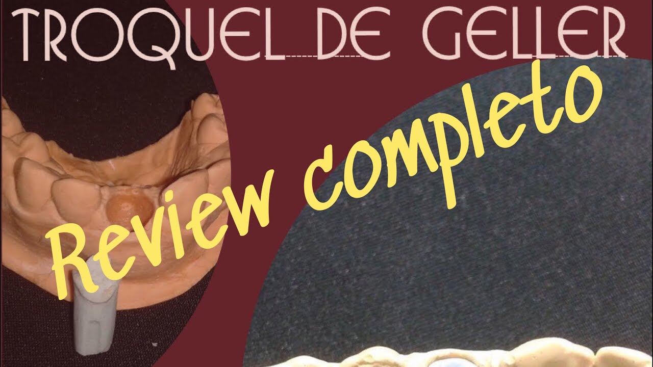 TROQUEL DE GELLER- Review completo