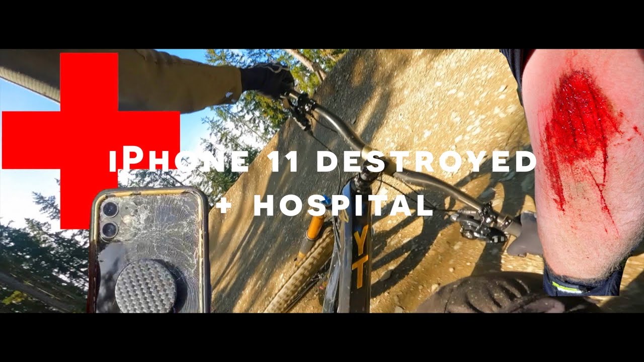 Destroyed my iPhone 11, thumb and nearly my GoPro Hero 9 in Bikepark Leogang // Hot Shots Crash