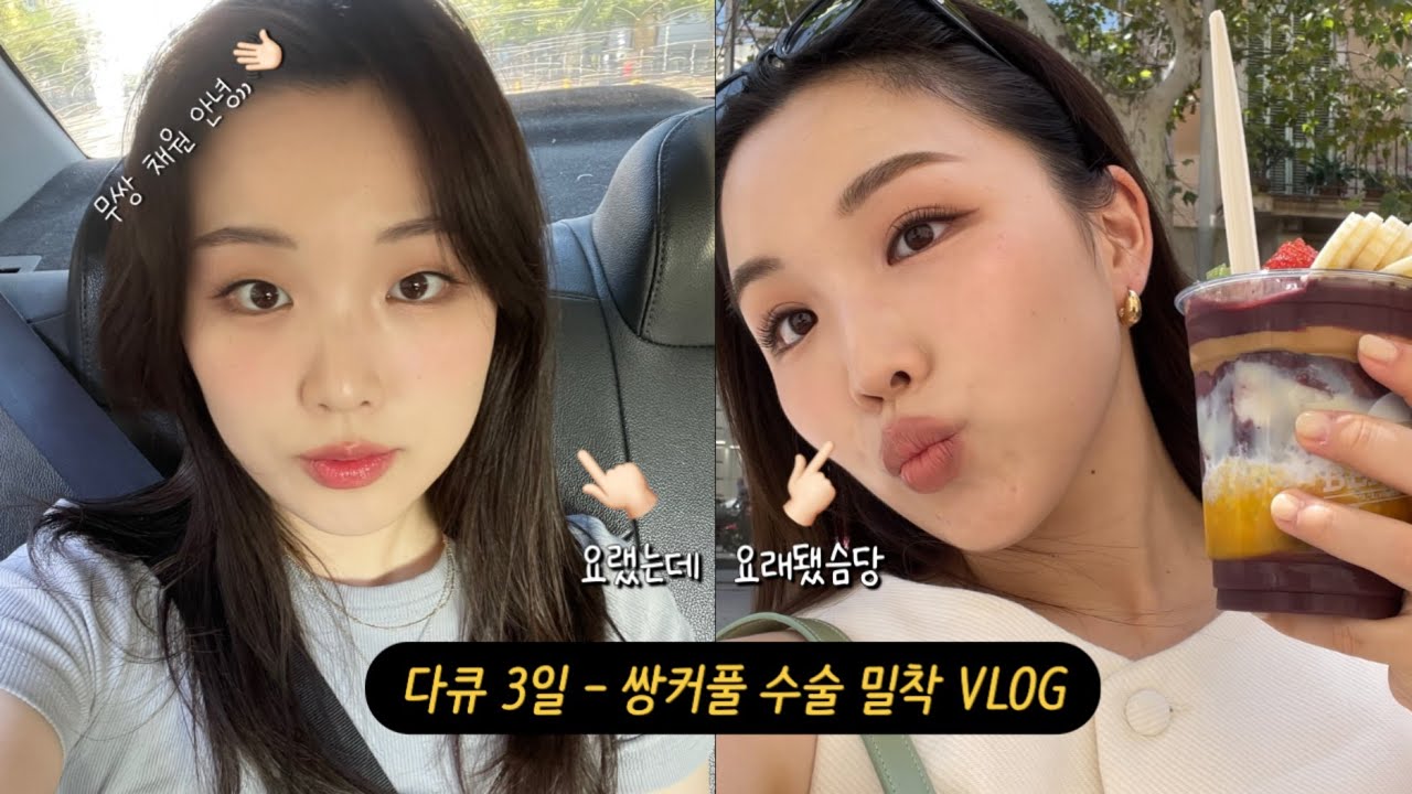 드디어 했습니다.. 쌍커풀..😌 | 매몰 눈매교정 윗트임 세미아웃라인 쌍수 브이로그
