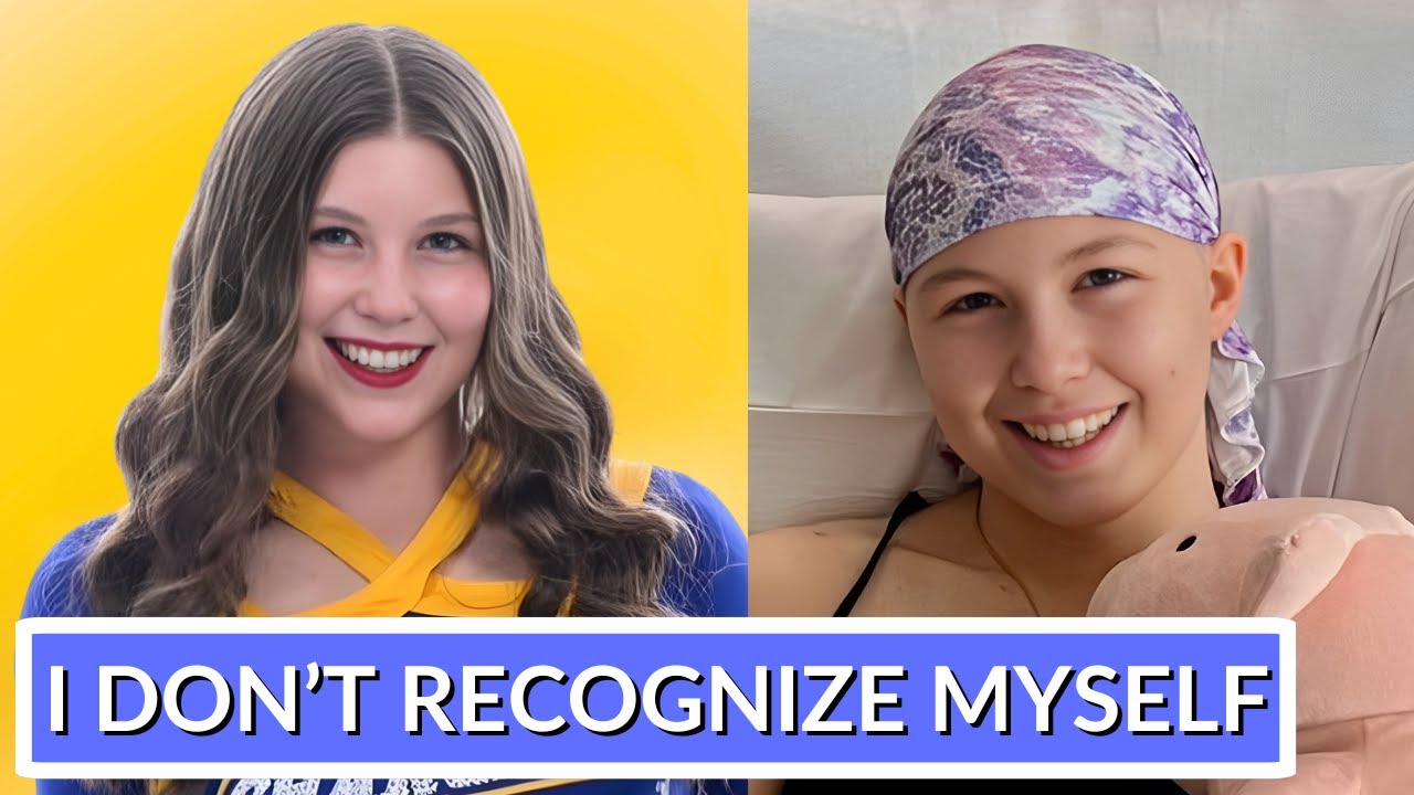 &ldquo;I Used to be Beautiful&rdquo; How Bone Cancer Changed Me I Kelly&rsquo;s Osteosarcoma Patient Story
