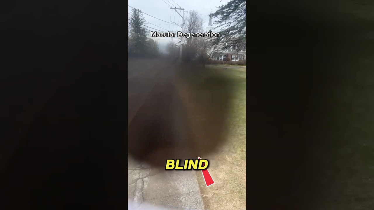 Что же на самом деле видят слепые люди? 😳👁️