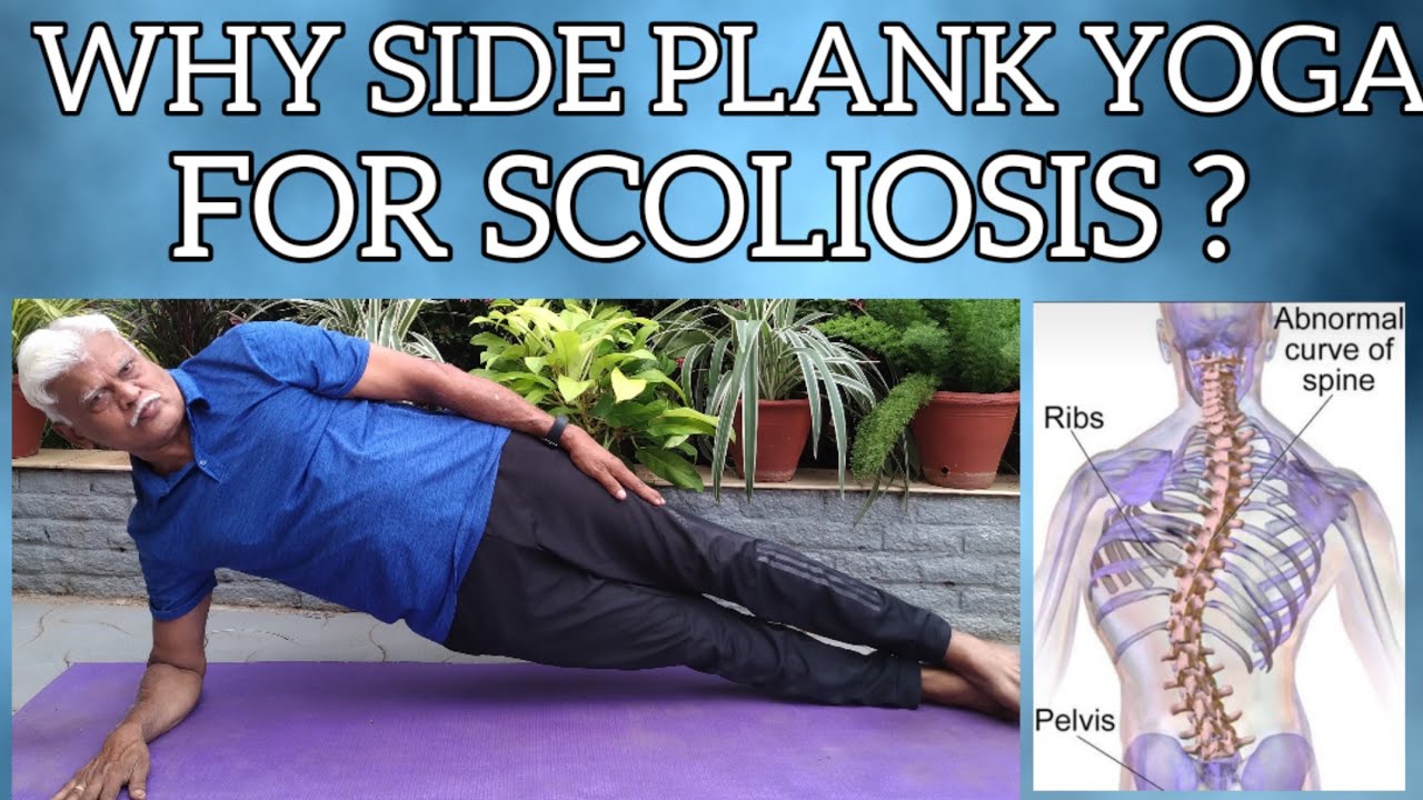 Why side plank yoga for Scoliosis?||#side plank yoga#Scoliosis#steps#benefits#