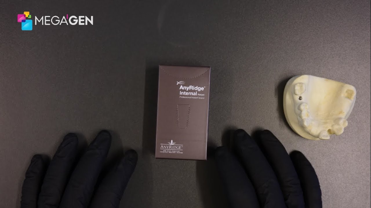 MegaGen AnyRidge:  Implants and Packaging