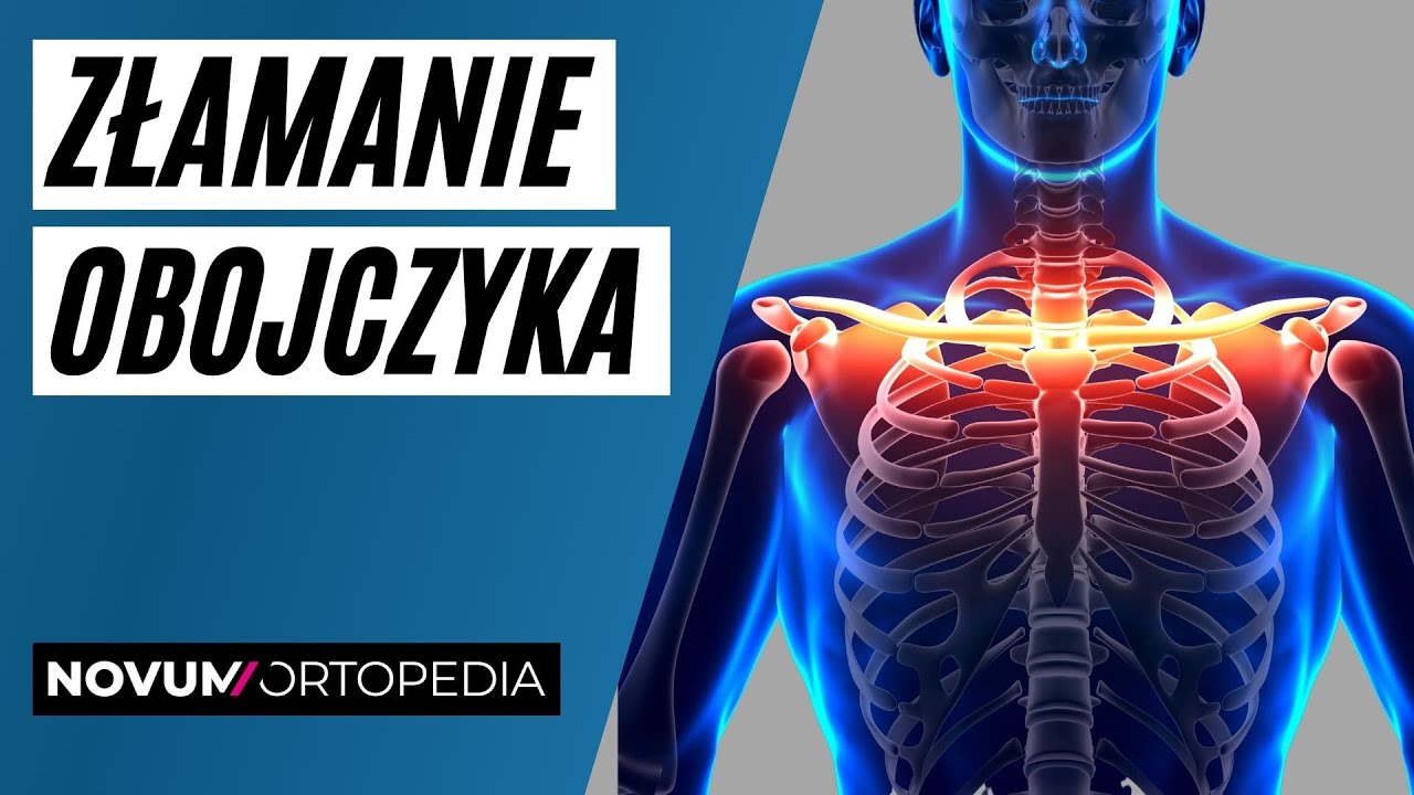 Złamanie obojczyka - sposoby leczenia i rehabilitacji | Novum Ortopedia