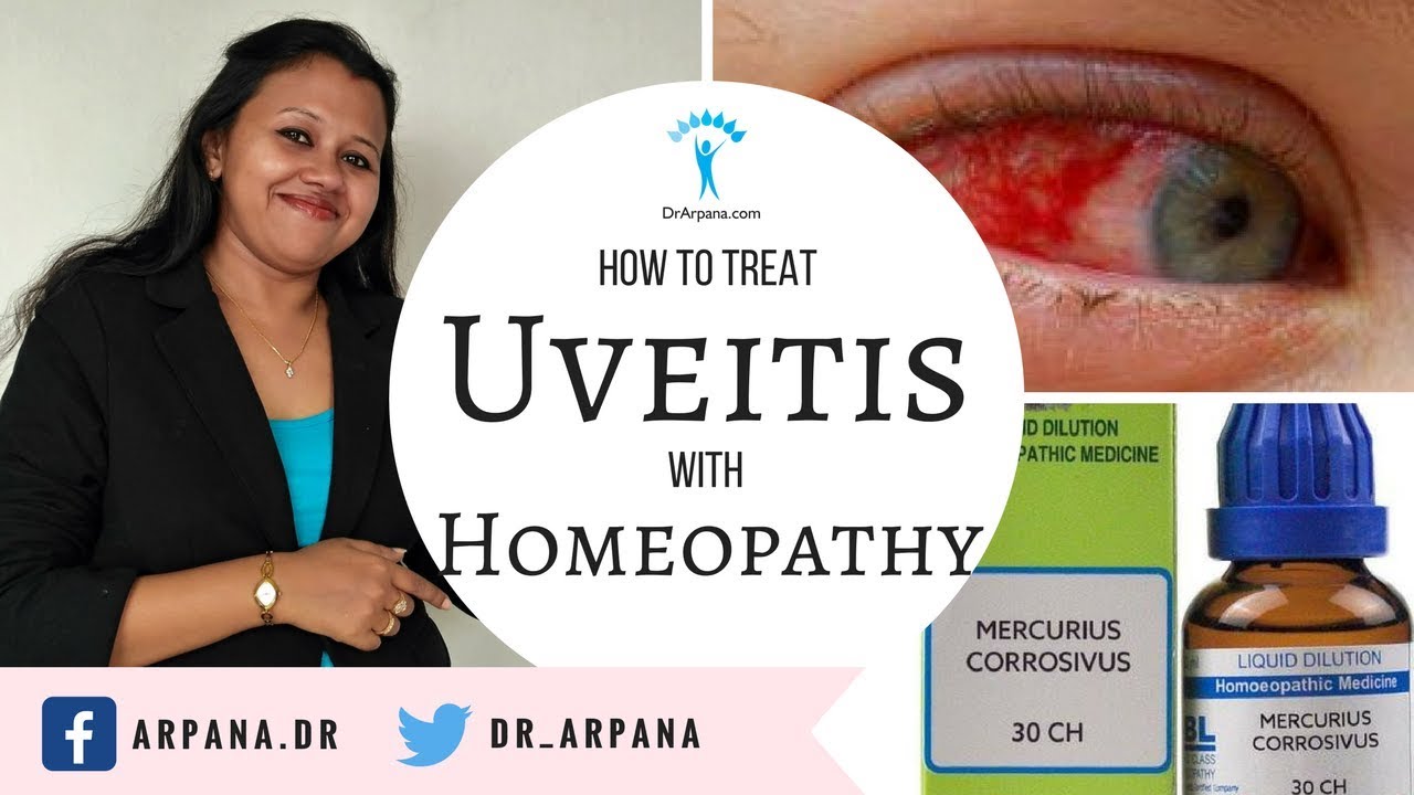यूवाइटिस के लक्षण, कारण, और होम्योपैथिक दवाई || Homeopathic Medicine For UVEITIS (Eye Inflammation)