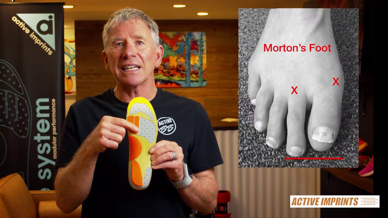 Determining Your Foot-type by Active Imprints