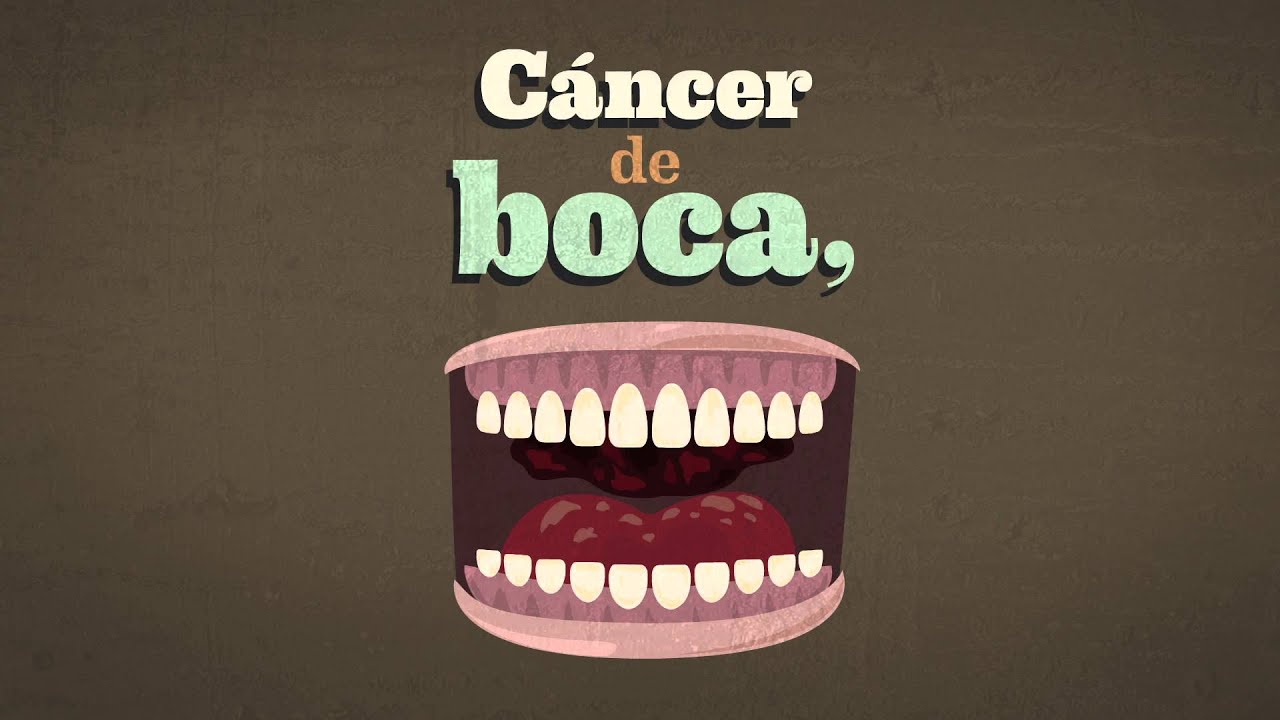 Prevención del Consumo de Alcohol