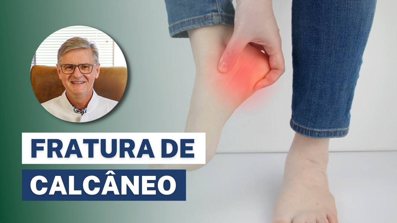 Fratura de Calc&acirc;neo (no Calcanhar) - Sintomas, Diagn&oacute;stico e Tratamento
