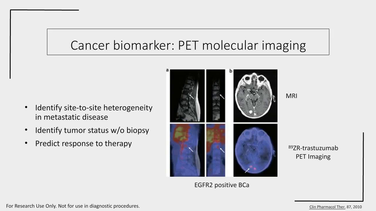 Androgen signaling in advanced prostate cancer models using noninvasive hyper polarized M
