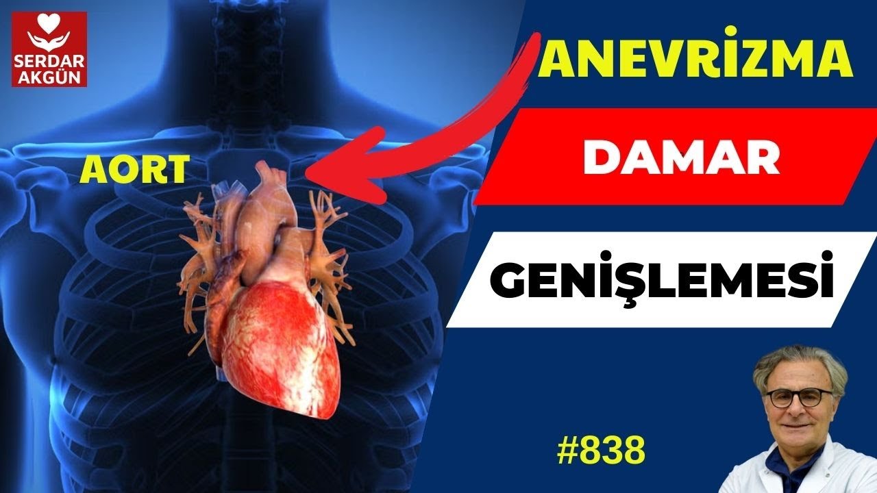 839. Sağlık, Damarda Balonlaşma, Damarda Baloncuk, Prof.Dr.Serdar Akgün,Tıp , Bypass Doktor