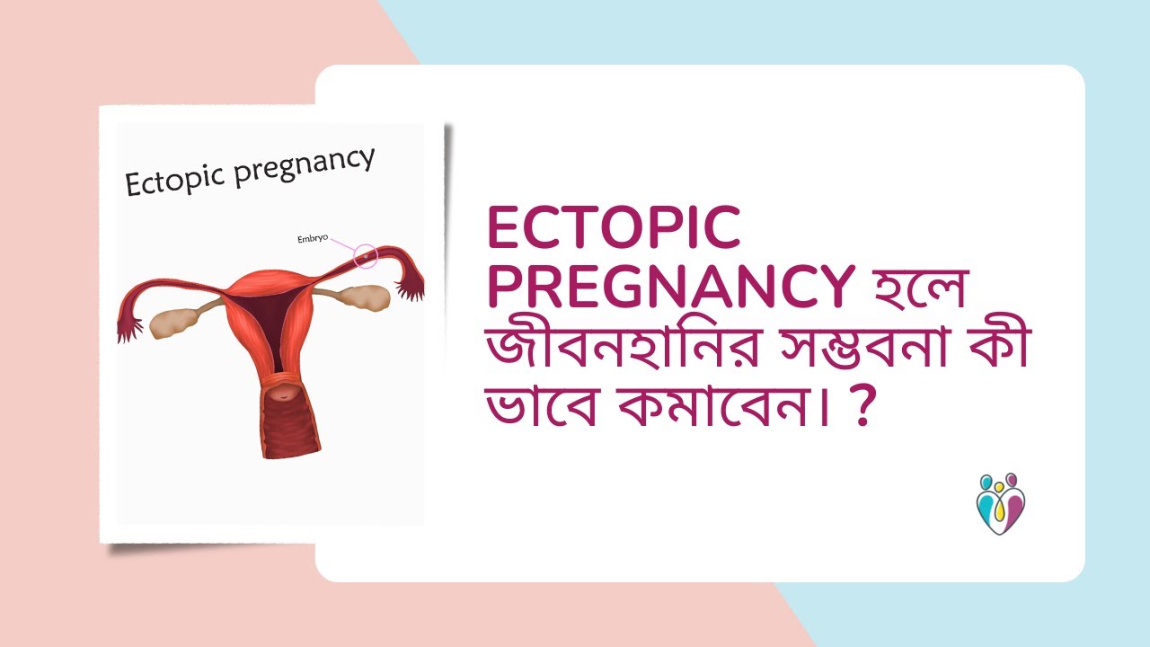 Ectopic pregnancy হলে জীবনহানির সম্ভবনা কী ভাবে কমাবেন ? | Dr Indranil Saha