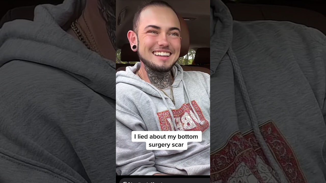 I lied about bottom surgery FTM