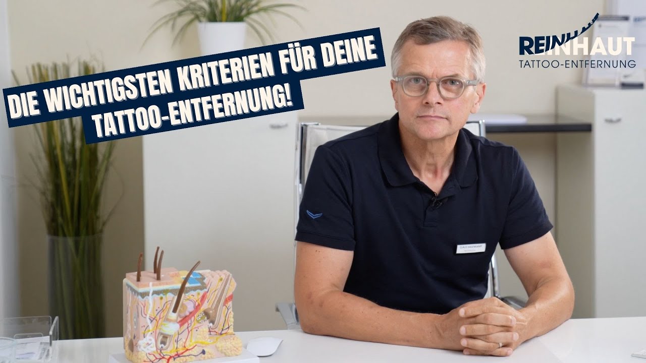 Die 11 WICHTIGSTEN Kriterien für deine Tattoo-Entfernung!