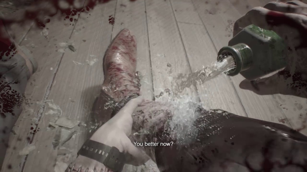 RESIDENT EVIL 7 biohazard Reattaching my leg?