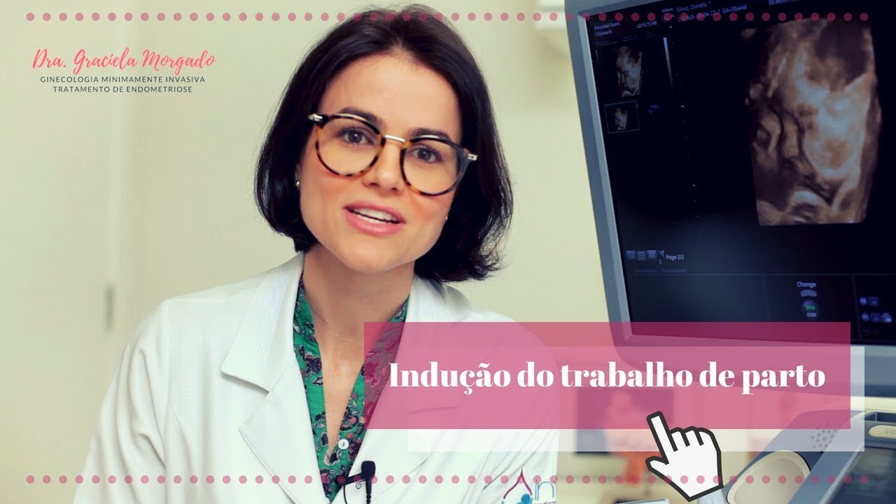 Indução do trabalho de parto