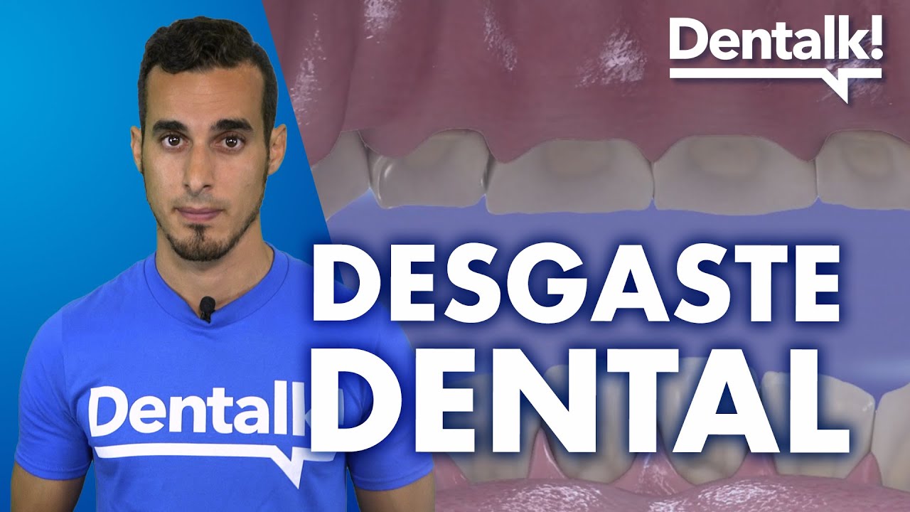 Todo sobre el DESGASTE DENTAL - Causas y tratamiento | Dentalk! ©