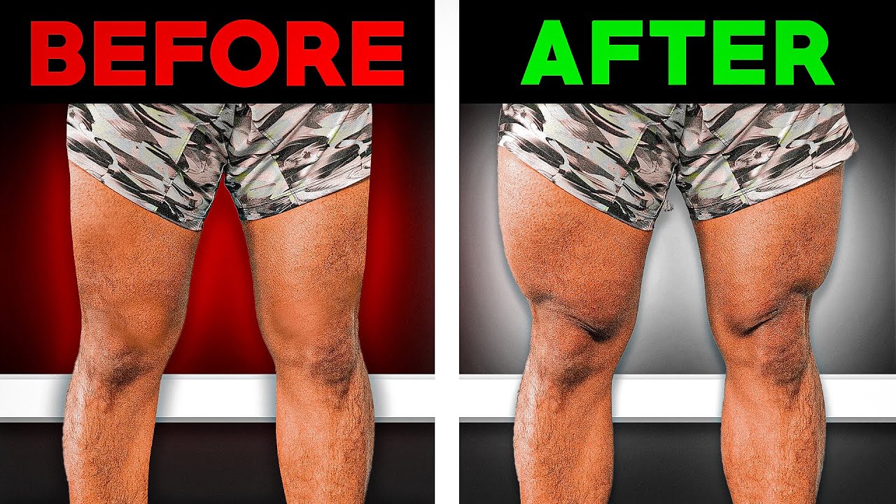 5 Essential Exercises to Grow Your Quads After ACL Surgery