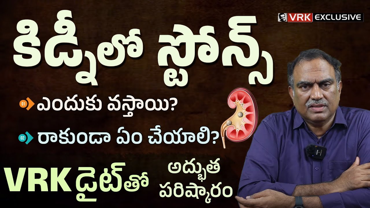 Dr. VRK on Kidney Stones: Causes, Prevention, Diet | Kidney Stone Treatment in VRK Diet | #health