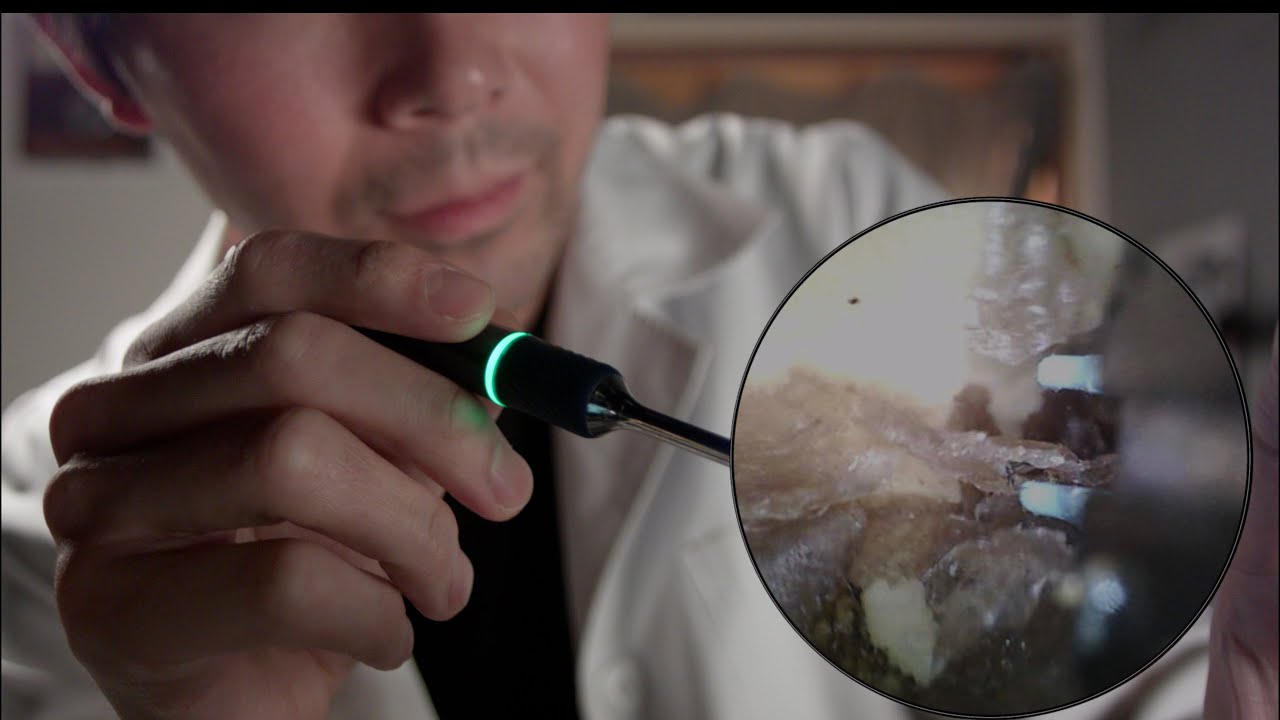 Чистка ушей крупным планом с мини-камерой – ASMR ролевая игра [Англ. субтитры]