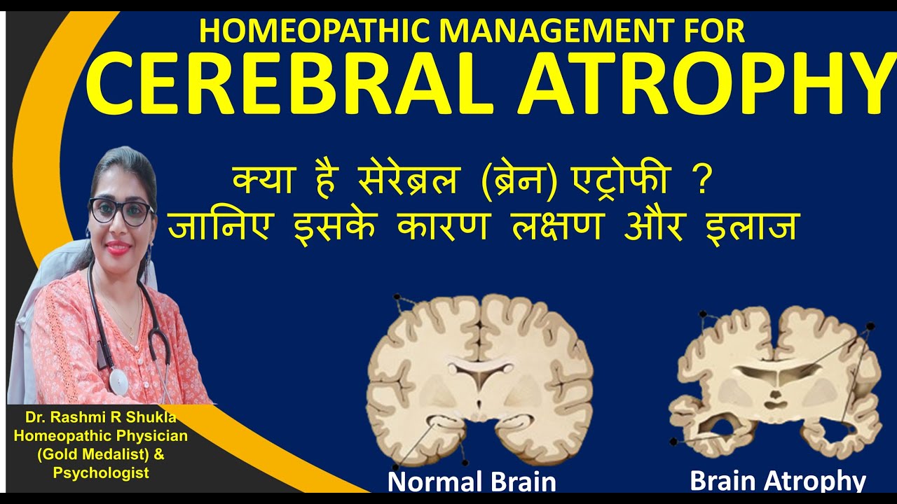 सोचने याद रखने में दिक्कत,रोज़मर्रा के काम करने में परेशानी| Cerebral atrophy homeopathic treatment