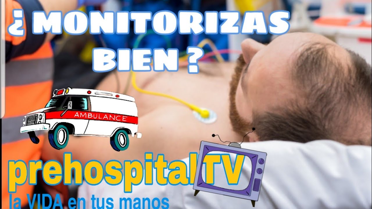 ERRORES EN LA MONITORIZACION BASICA Y ECG 12D