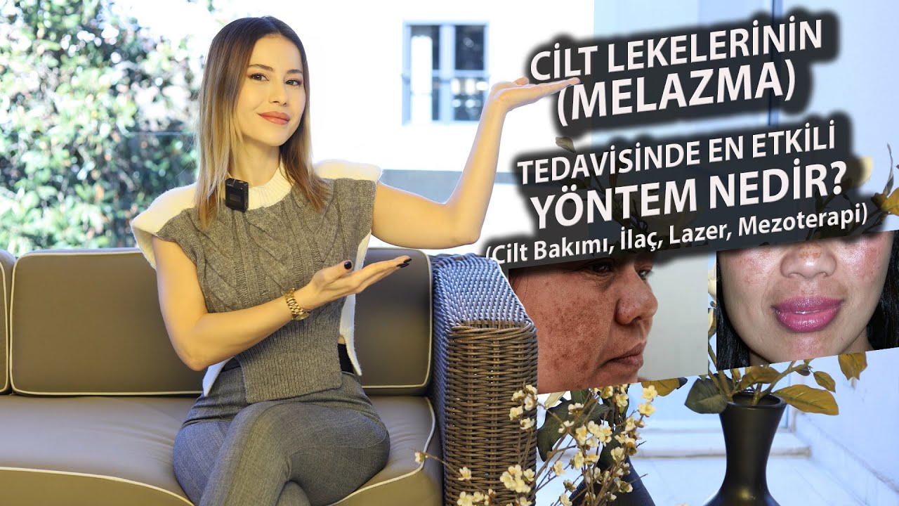 CİLT LEKELERİNİN (MELAZMA) TEDAVİSİNDE EN ETKİLİ YÖNTEM NEDİR? LEKELERDEN NASIL KURTULURUZ?