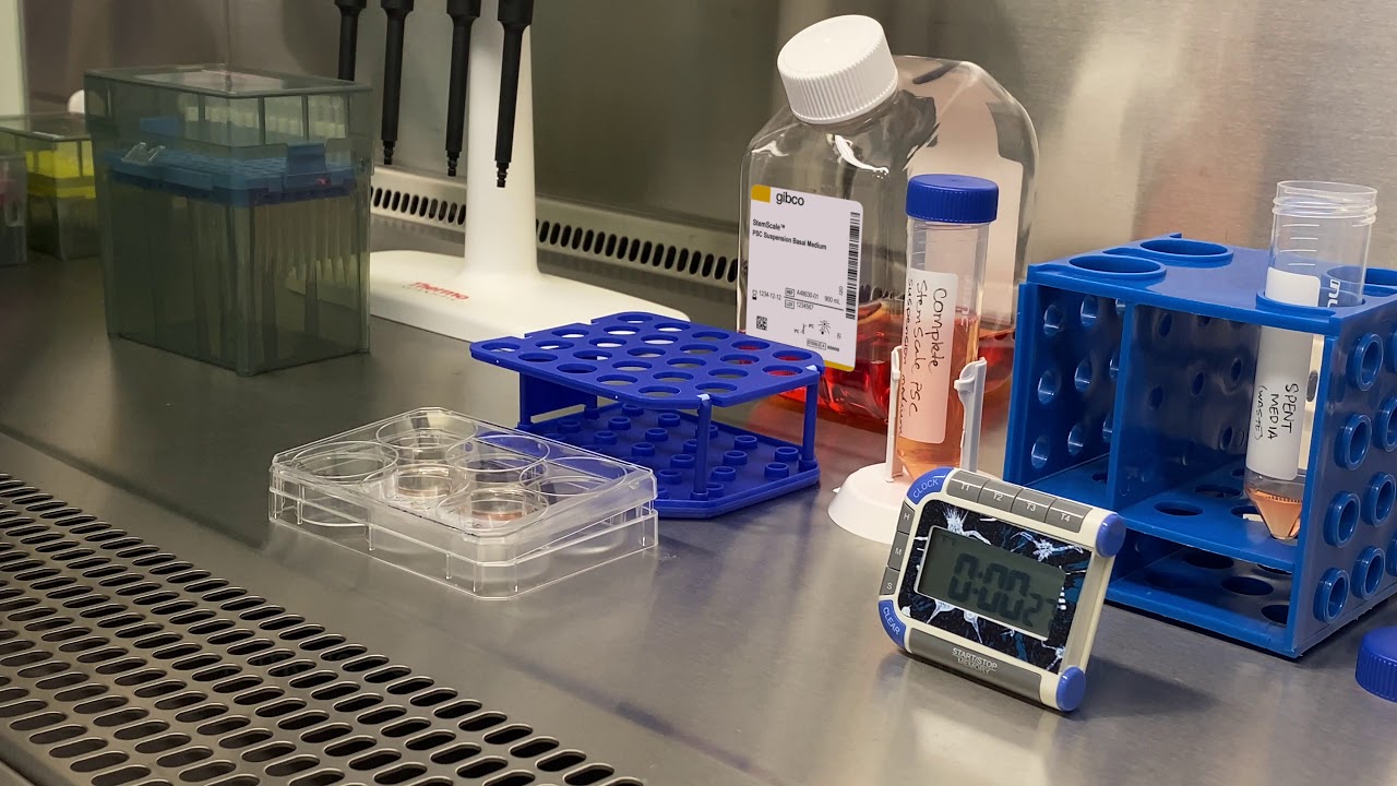 How to culture pluripotent stem cells in suspension: Maintenance and Feeding of PSC cultures