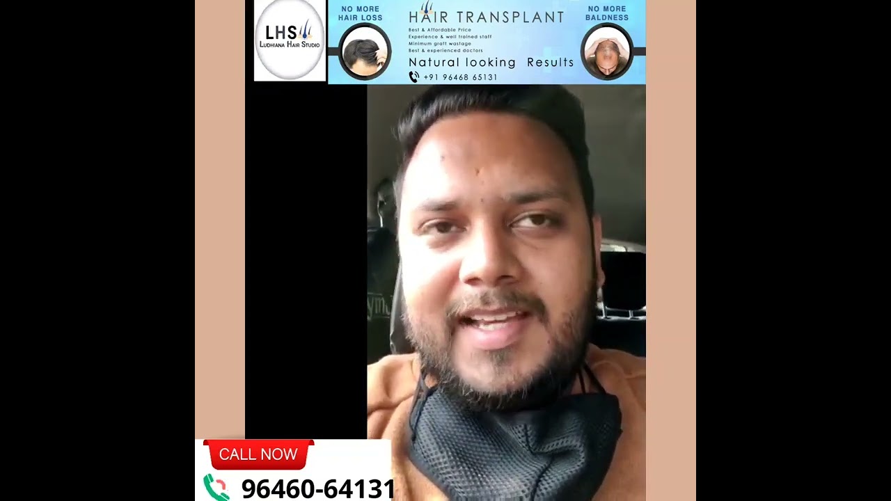✅ Best Hair Transplant in Punjab I Satisfied Client I Before & After Hair Transplant I LHS