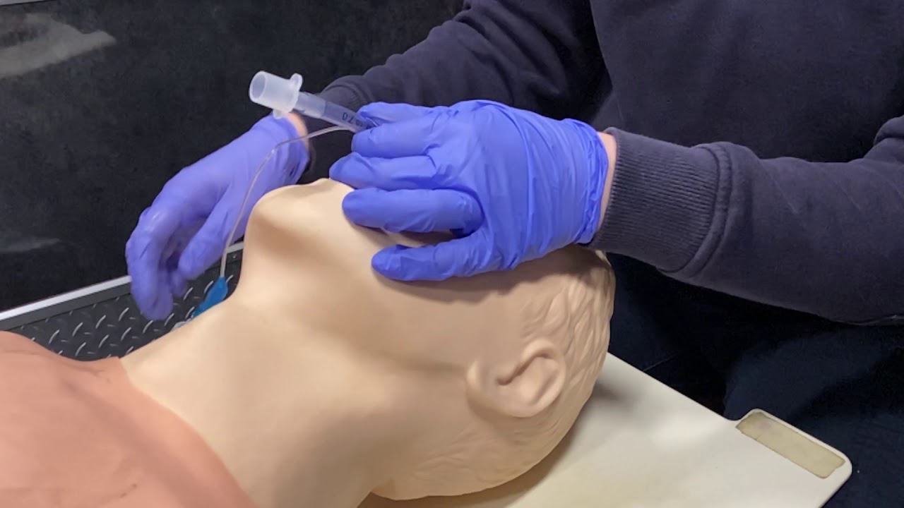 Nasotracheal Intubation