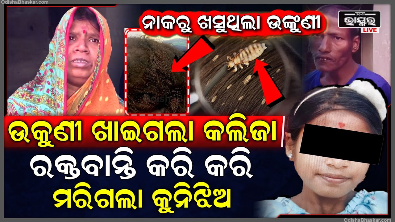 ଉକୁଣୀ ନେଇଗଲା କୁନିଝିଅର ଜୀବନ ,କାନ୍ଦୁଛି ପୁରା ପରିବାର ...Beware :Lice Killed A young Girl