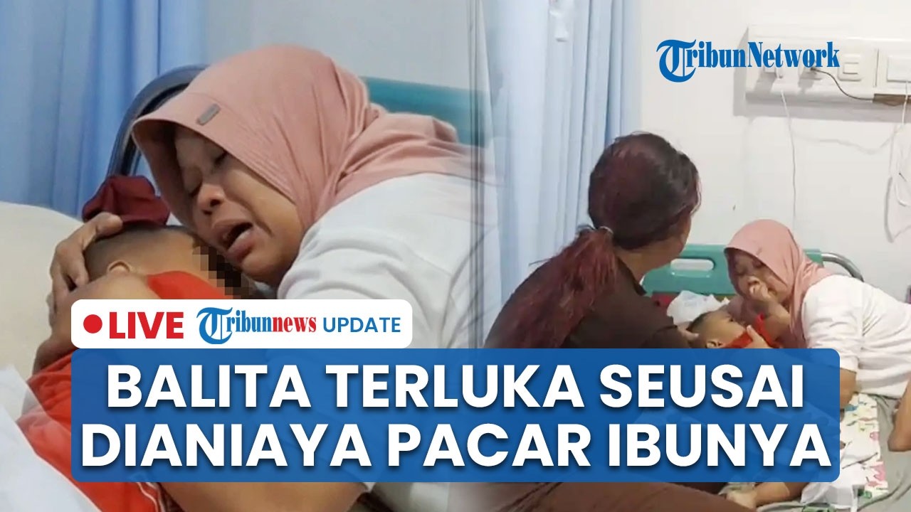 🔴LIVE: Balita 2,5 Tahun di Karawang Alami Luka Serius seusai Dianiaya Pacar Ibu Pakai Tang